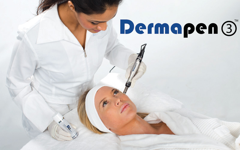 Dermapen Microneedling